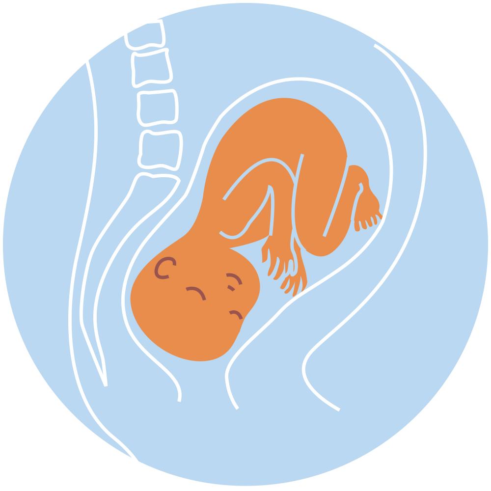 baby position in womb - Posterior position