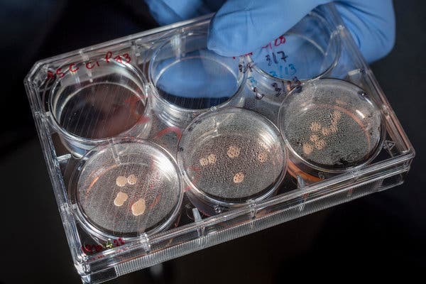 A tray of brain organoids cultured with a Neanderthal gene in Dr. Muotri&rsquo;s lab. The neurons formed fewer connections, the researchers found.