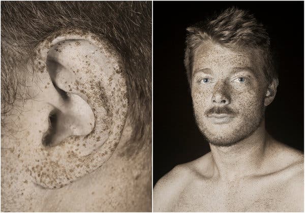 Freckle juice: Parisian photographer Pierre-Louis Ferrer highlights the skin&rsquo;s spots.