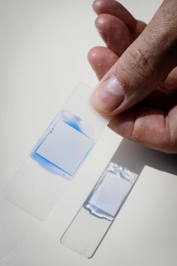A microscope slide with inactive Candida auris collected from a patient in the United States.