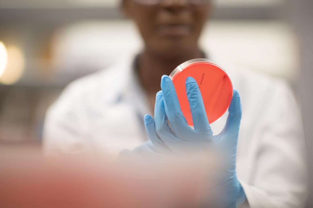 scientist looking at a petri dish