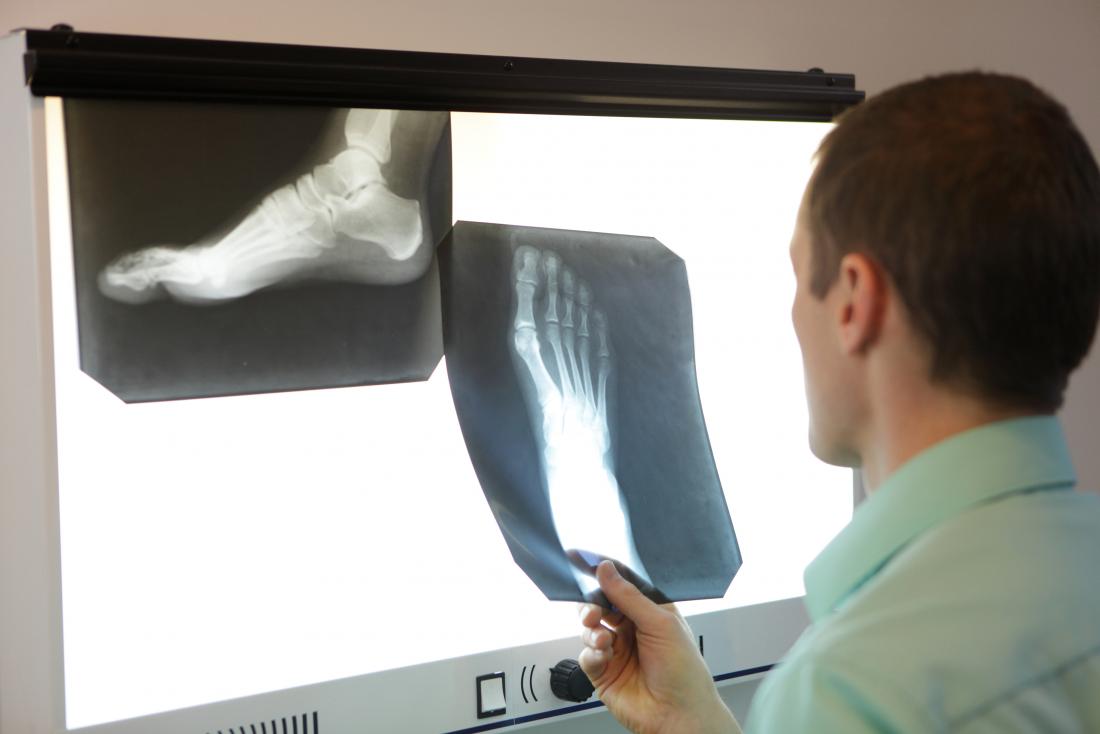 Doctor looking at a foot X-ray