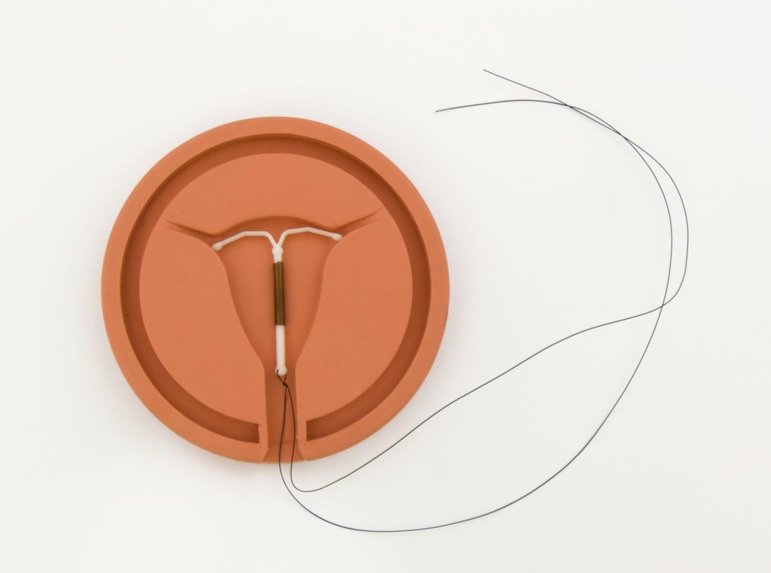 an IUD 