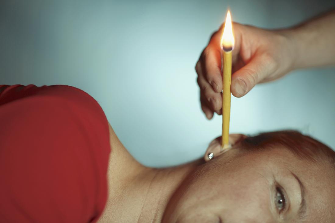 Ear candle being used on woman.