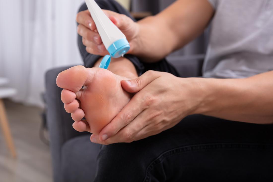 Person putting lotion on their foot to relieve itchy dry skin