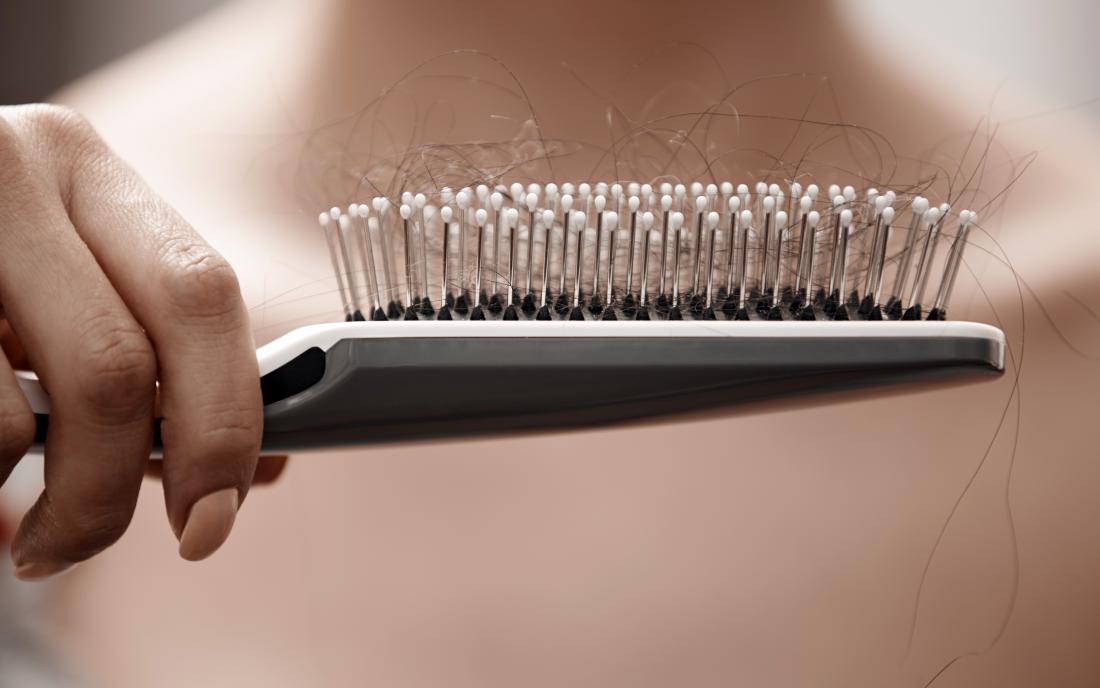 A women who needs treatment for Hair loss as he holds her hairbrush with lots of hair in it. 